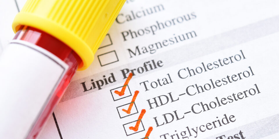 What does a lipid panel test for? Rachel Brown, MD, explained what you need to know about your lipid panel results and when to expect a follow-up.