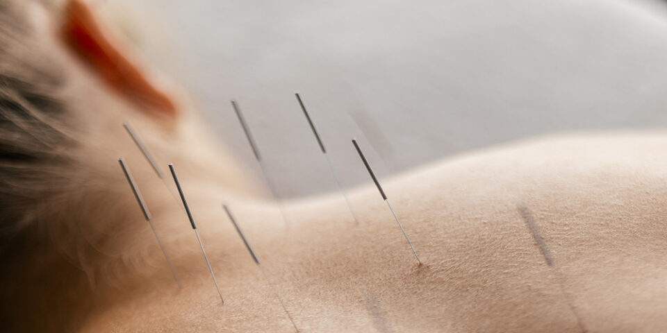 Sankeerth Challagundla, MD, discusses pain relief options, including non-opioid alternatives and holistic methods.