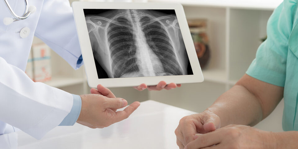 Pulmonologist and critical care specialist Matthew Varner, DO, spoke with us about how emphysema differs from COPD and more.