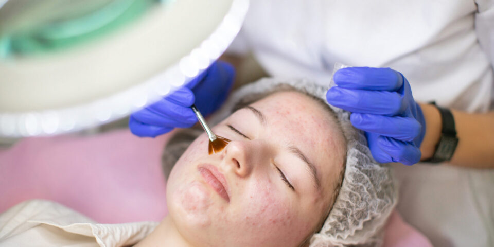 Cosmetic procedures for teens and young adults
