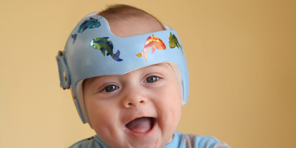 Pediatric neurosurgeon Lacey Carter, MD, and plastic surgeon Dr. David Lobb treat craniofacial deformity in children. Learn more.